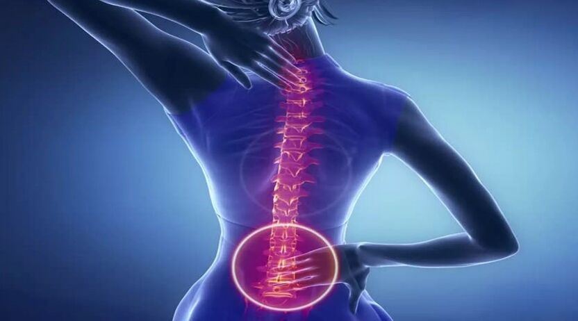 The spine osteochondrosis