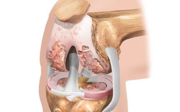 The schema of the ligaments
