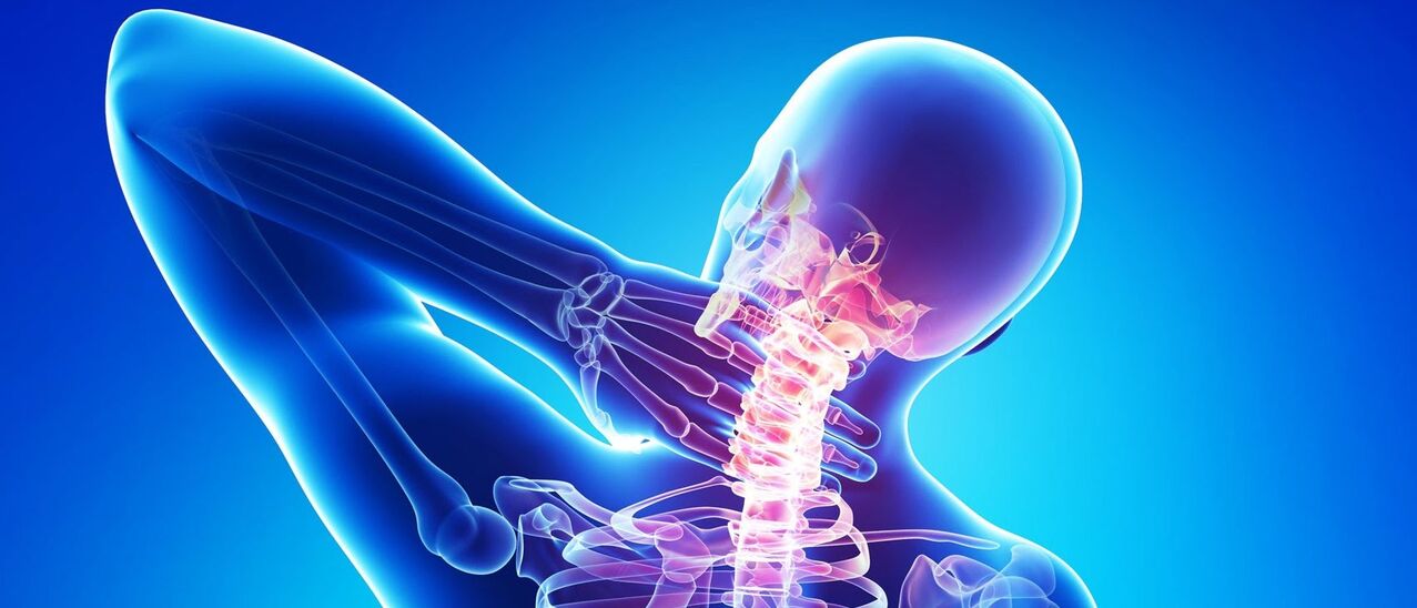Cervical osteochondrosis is a pathological process in the spine