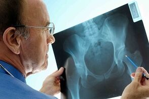 The hip joint is a joint joint joint