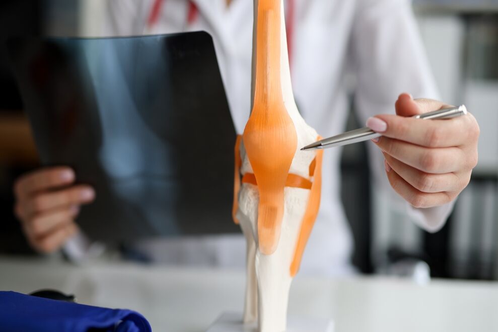 Presentation of a joint in which degenerative changes lead to the development of arthrosis